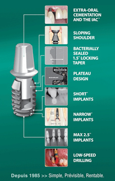 Implant court Bicon