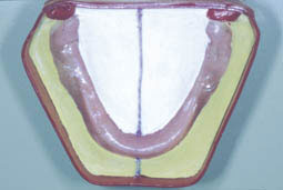Fig. 11 :  Coffrage de l'empreinte et réalisation des clefs piezographiques (C.C.T.D)