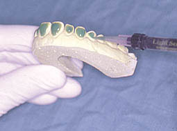 Fig. 3 : Création de réservoir en injectant une résine photopolymérisable au niveau des faces à éclaircir 