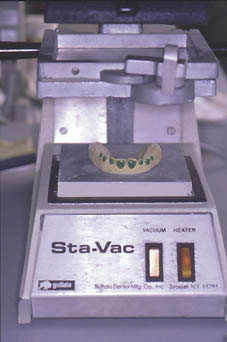 Fig. 4 : Thermoformage de la gouttière en polyvinyle sur le modèle