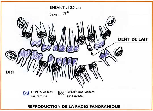 Reproction radio panoramique