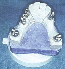 Fig. 7 : Morphologie des éléments fixés (C.C.T.D)