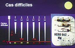 Fig. 10 : Instrumentation pour cas difficiles