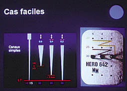 Fig. 8 : Instrumentation pour cas faciles