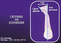 Fig. 7 : Méthode de Schneider pour évaluer l’angle de courbure