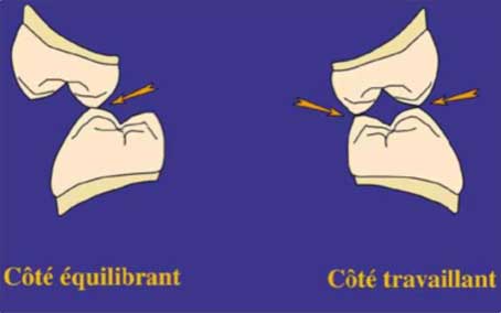 Fig. 25 : Contacts occlusaux en diduction  gauche (10)