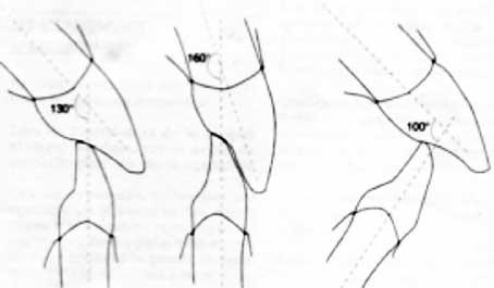 Fig.4 : Angle inter-incisif (7)