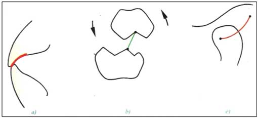 Fig.6 : En propulsion (16)