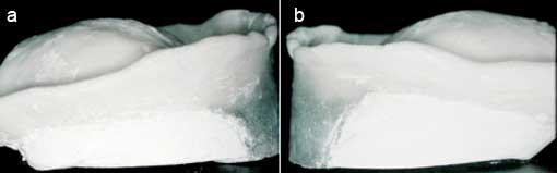 Fig. 12 : Courbe individuelle d’occlusion. a- vue latérale droite. b- vue latérale gauche Fig. 12 : Courbe individuelle d’occlusion. a- vue latérale droite. b- vue latérale gauche