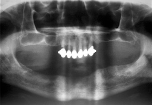 fig. 5 : Radiographie panoramique.