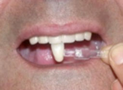 fig. 24 : Choix de la teinte.  fig. 24 : Choix de la teinte.