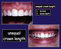 M.K. Kokich   V.G. Kokich Effective teaching the art of engagement Part 1 and 2.Journal of Orthodontics, vol 33, 2006, 214