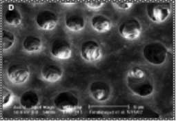 Fig 5 :Boue dentinaire sur la surface d’un canal radiculaire irrigué avec une solution d’hypochlorite de sodium à 1,3% et un produit de rinçage final à base de MTAD (20).