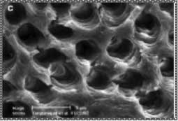 Fig 3b : Boue dentinaire sur la surface d’un canal radiculaire irrigué avec une solution d’hypochlorite de sodium à 5,25% et un produit de rinçage final à base d’EDTA à 17% (20).