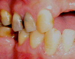 Fig.7 : Aspect clinique après 6 mois de traitement