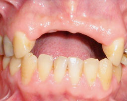 Fig.8 : Aspect clinique après 6 mois de traitement