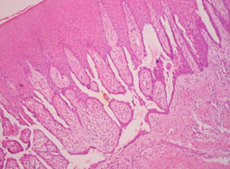 Fig. 5 : Histologie HE x 200