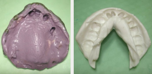 Fig.12 : Empreintes secondaires.