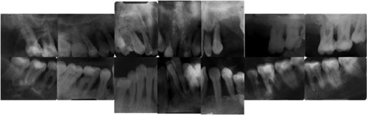 Fig.3 : Bilan radiographique