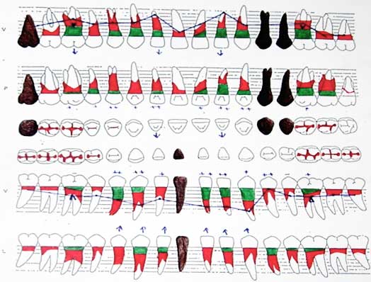 Fig.2 : Sharting initial