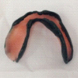 Fig.10 : Joint périphérique Fig.10 : Joint périphérique