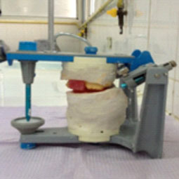 Fig.15 : Transfert de la relation centrée sur articulateur (Quick Master) Fig.15 : Transfert de la relation centrée sur articulateur (Quick Master)