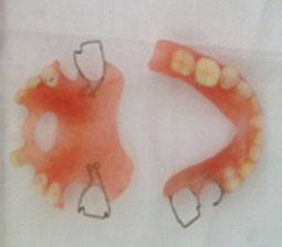 Fig.18 : Prothèses polymérisées et polies Fig.18 : Prothèses polymérisées et polies