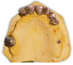 Fig.13 : Coulée des éléments fixés                                