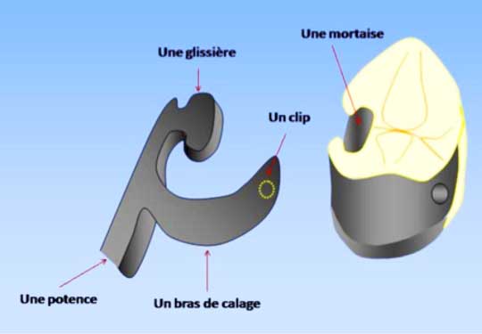 Schéma des différentes parties du crochet équipoise.