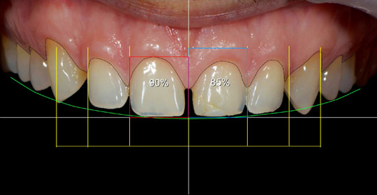 DSD 3