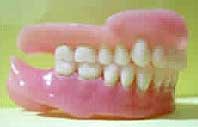 prothèse dentaire