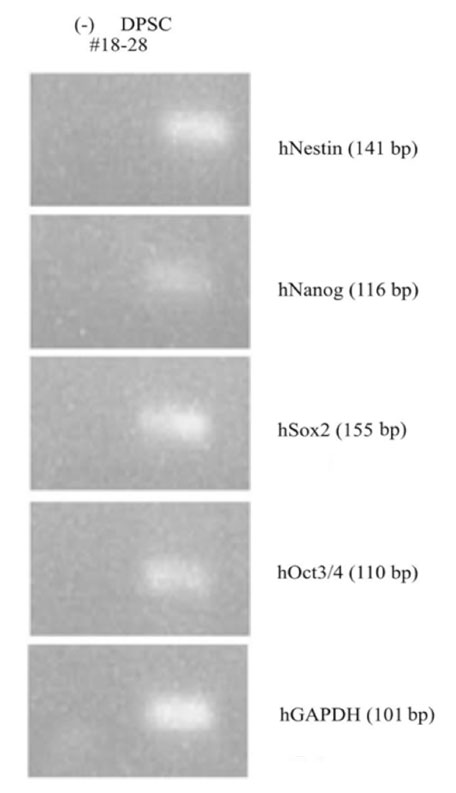 RT-PCR.