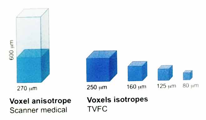 Voxel anisotrope dans le scanner medical. Voxels isotropes dans les CBCT.