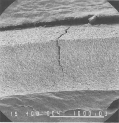 Photomicrographie de la fracture d’un crochet par fatigue