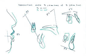 Fig. 16