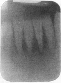 Fig 3: Cas clinique N°2 Examen radiologique