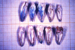 Fig. 6: Groupe II (obturation au Thermafil)