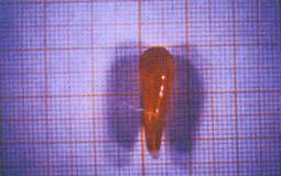 Fig. 1: Vernissage de la dent Fig. 1: Vernissage de la dent