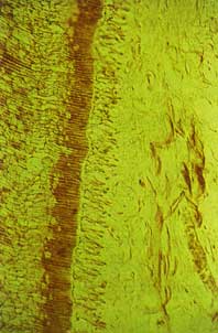 Fig. 1 : Coupe longitudinale des tubulis dentinaires, aspect histologique d'une pulpe saine : continuité de la couche odontoblastique en palissade, quasiabsence de cellules inflammatoires au niveau de la substance fondamentale (Service d'odontologie conservatrice).