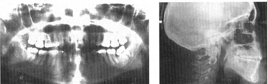 Fig. 4: Radiographies après traitement