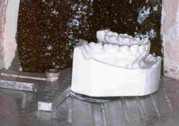 Fig 6 : Taille des angles postérieurs