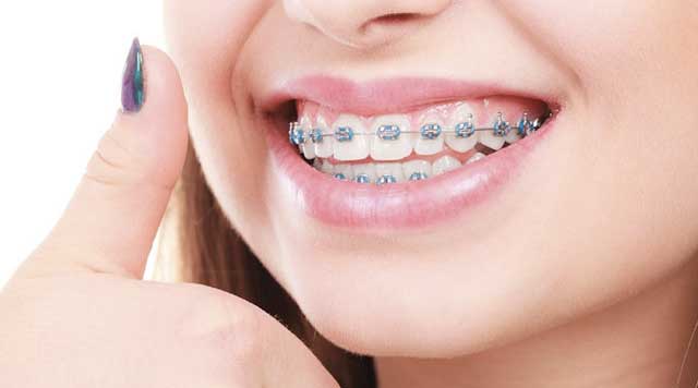 L'orthodontie