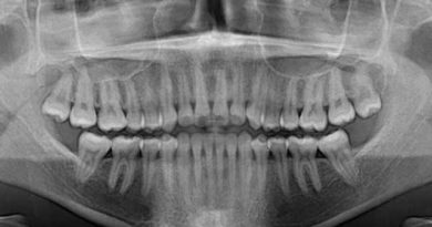 Type de radiographie dentaire