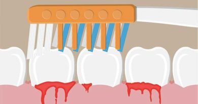 Saignement des gencives : Que faire ?