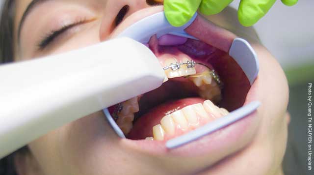 Appareil dentaire : à quoi s’attendre ?