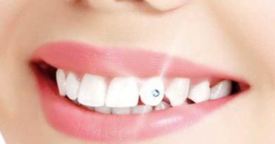 Bijoux dentaires : sont-ils nocifs pour la santé des dents ?