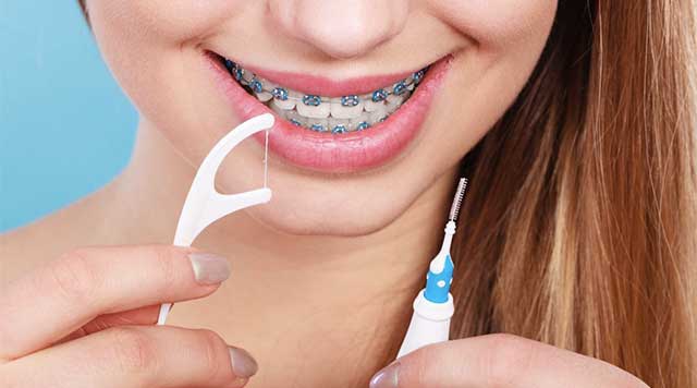 Conseils pour les porteurs d’un appareil orthodontique