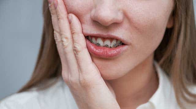 Douleur liée aux appareils dentaires : Conseils pour s’en débarrasser