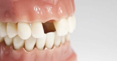 Perte des dents permanentes : causes et solutions