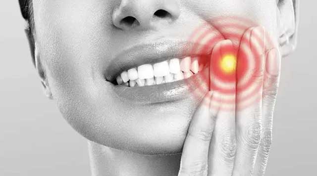 Qu’est-ce qu’un granulome dentaire ?